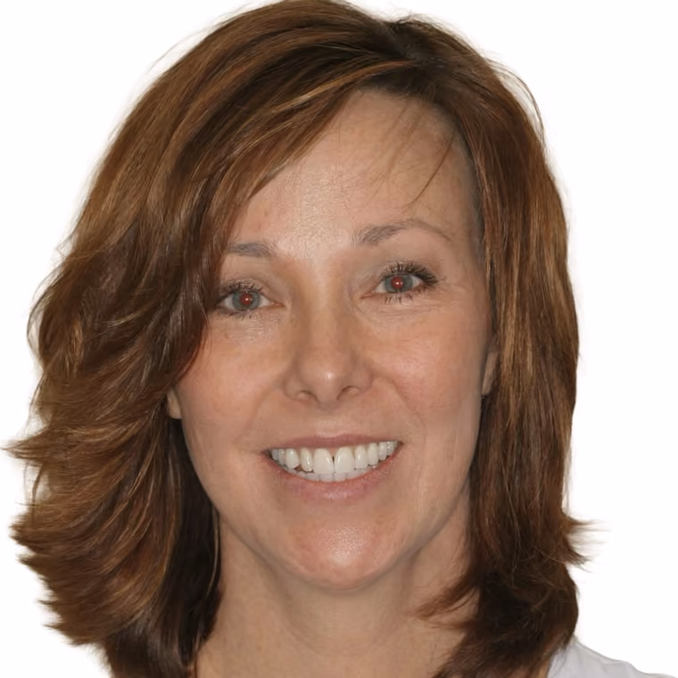 Before: Single-tooth bonding and recontouring